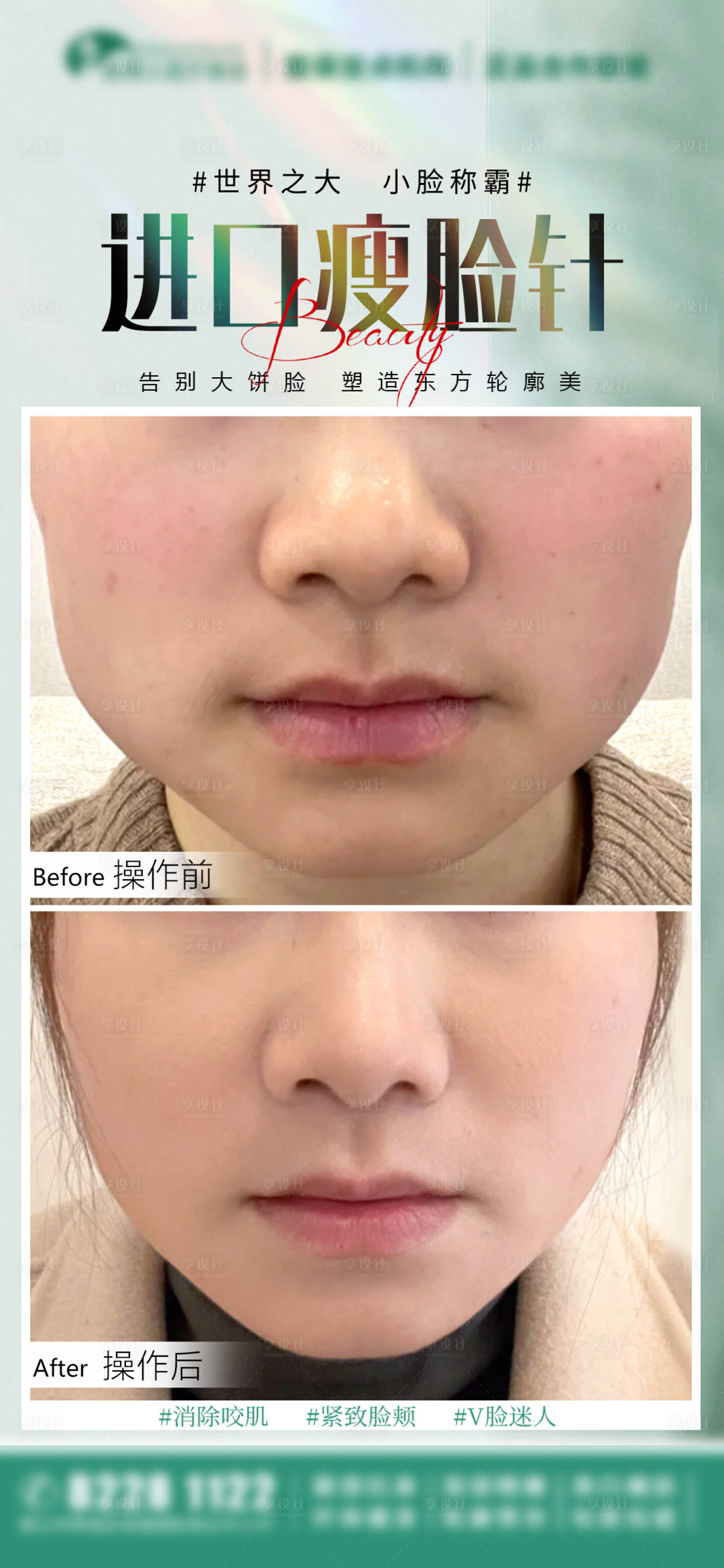源文件下載【享設(shè)計(jì)】搜索編號(hào)：56980026390909697【醫(yī)美案例宣傳海報(bào)】