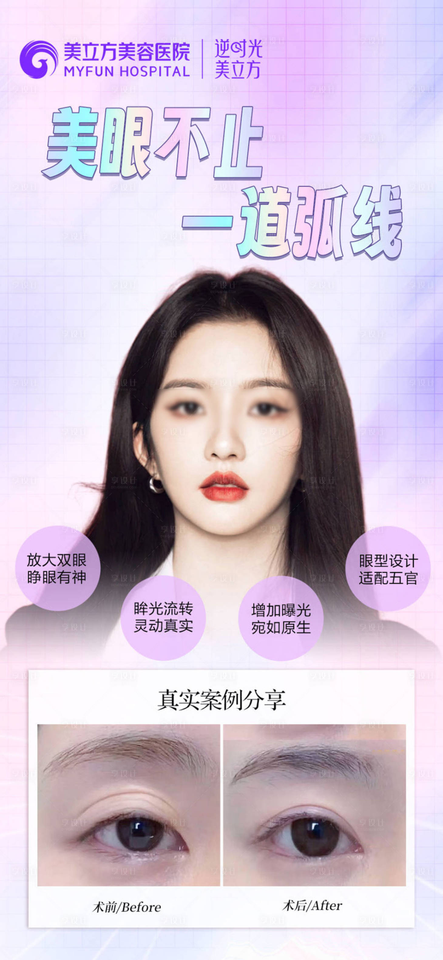 源文件下載【享設計】搜索編號：27340026009673294【醫美整形雙眼皮案例對比海報】