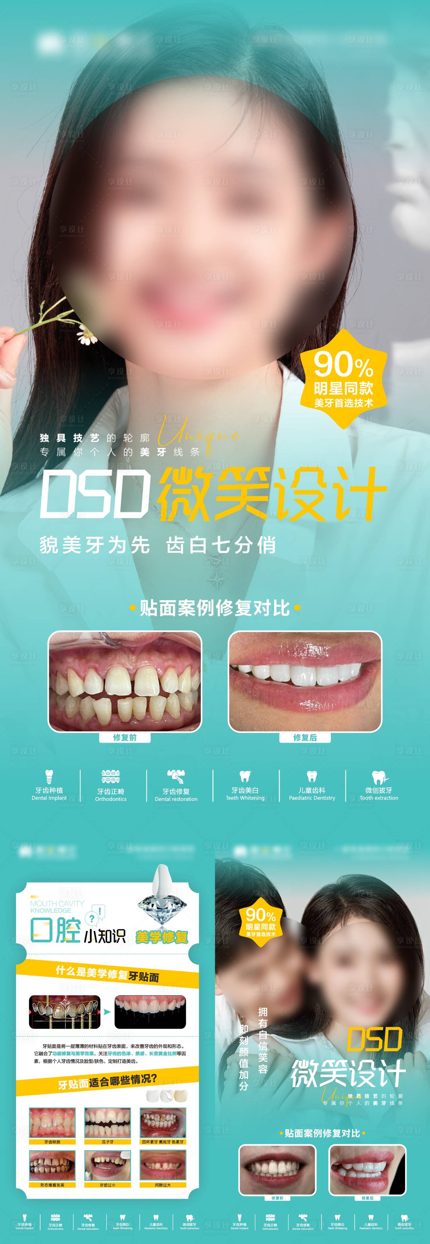 源文件下载【享设计】搜索编号：76300026404017754【牙贴面美牙口腔长图海报】