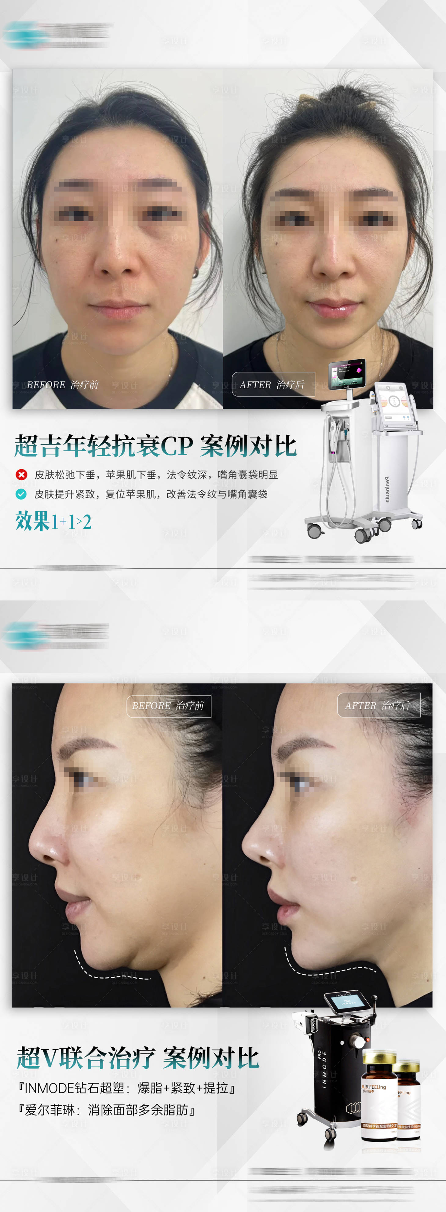 源文件下载【享设计】搜索编号：10700026064753306【热超联合V脸案例】