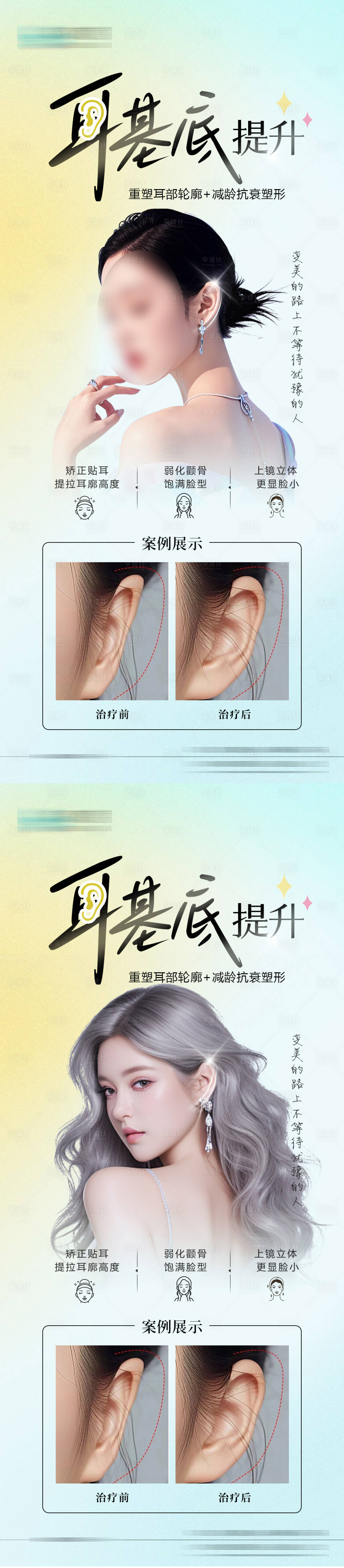 源文件下載【享設(shè)計】搜索編號：10490026319099326【醫(yī)美耳基底案例海報】