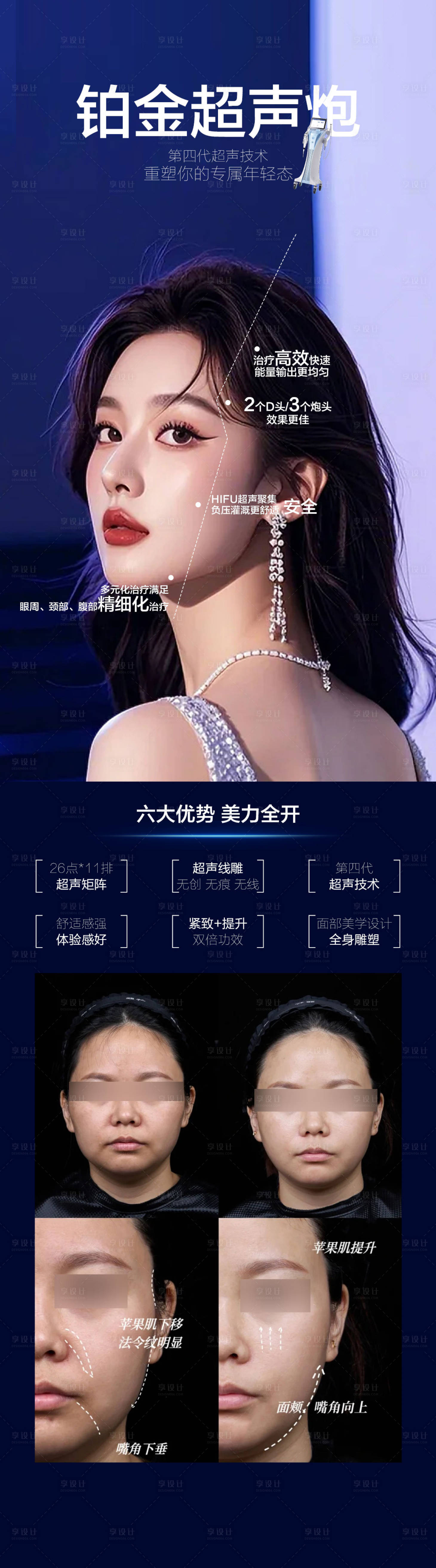 源文件下载【铂金超声炮】编号：24110026344427243