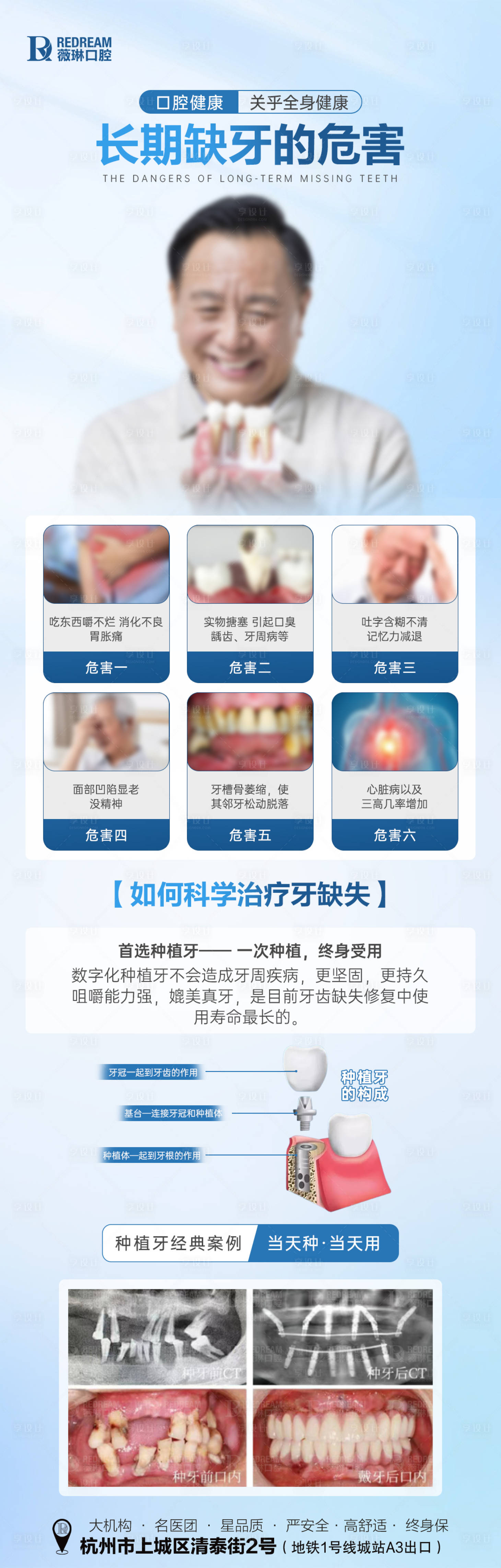 源文件下載【享設(shè)計(jì)】搜索編號(hào)：67040026143413949【口腔種植牙長(zhǎng)圖海報(bào)】
