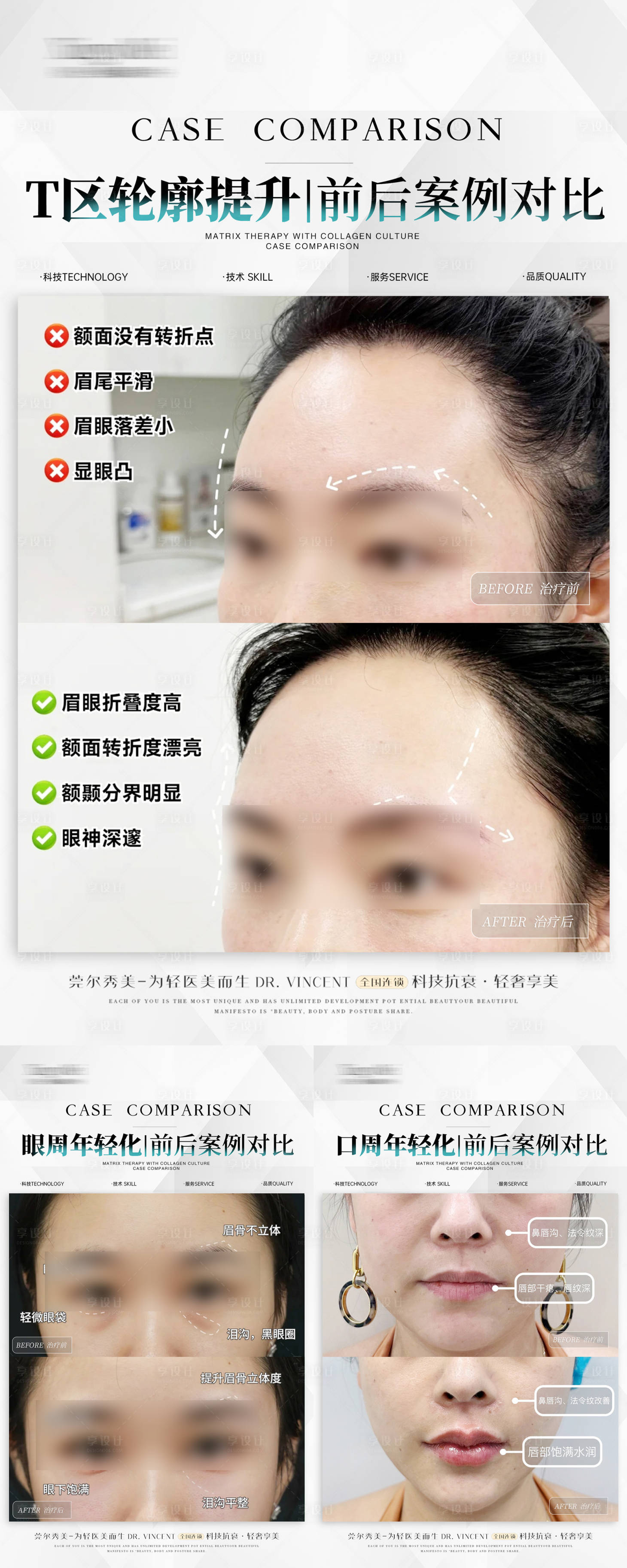源文件下载【享设计】搜索编号：78910026286587695【医美美业简约案例】