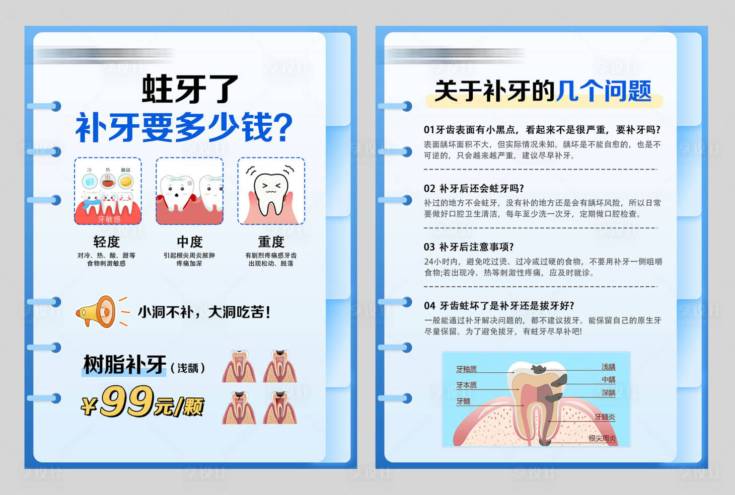 源文件下載【享設計】搜索編號：32980026020288031【口腔蛀牙科普單頁】