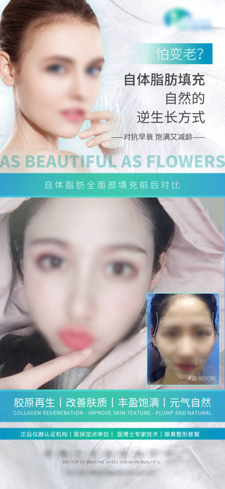 源文件下载【自体脂肪填充太阳穴案例宣传海报】编号：35180026477052244