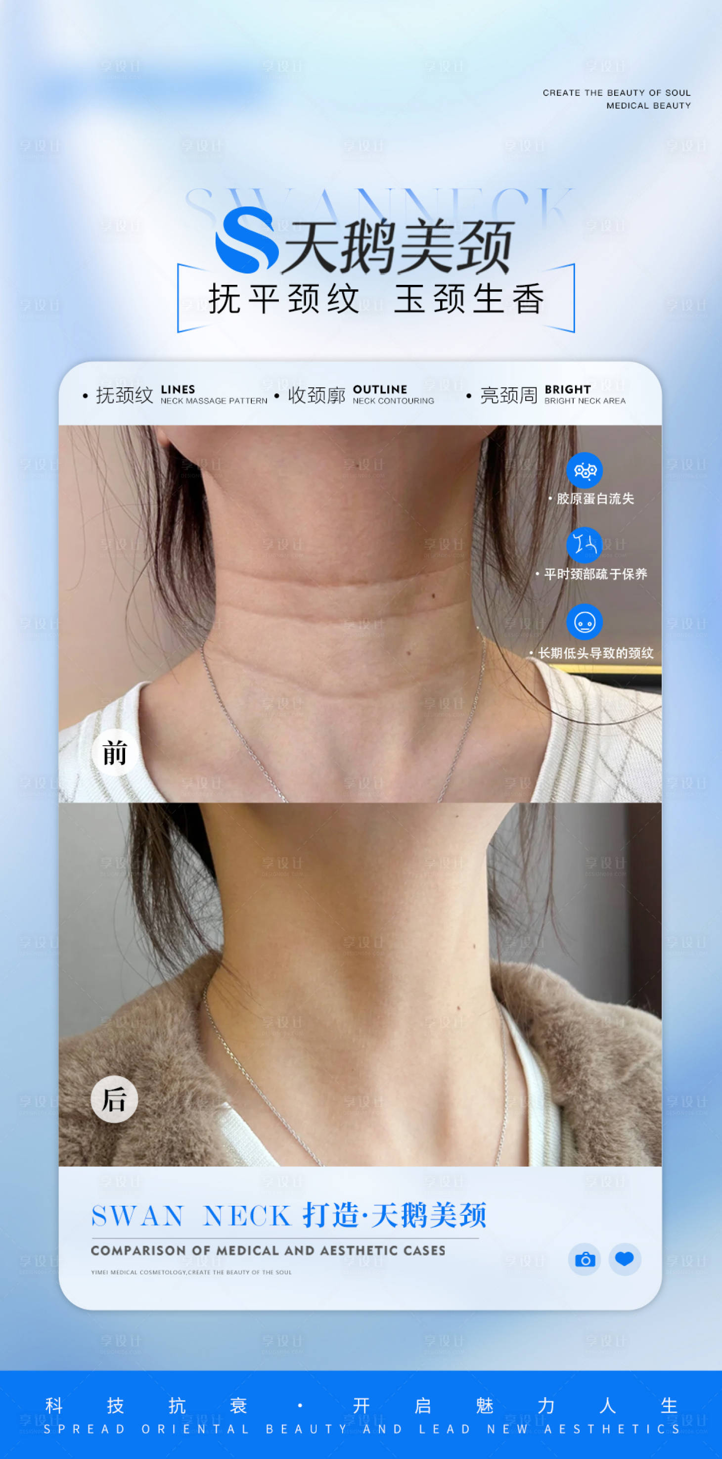 源文件下载【医美颈部抗衰案例对比海报】编号：76220026950198158