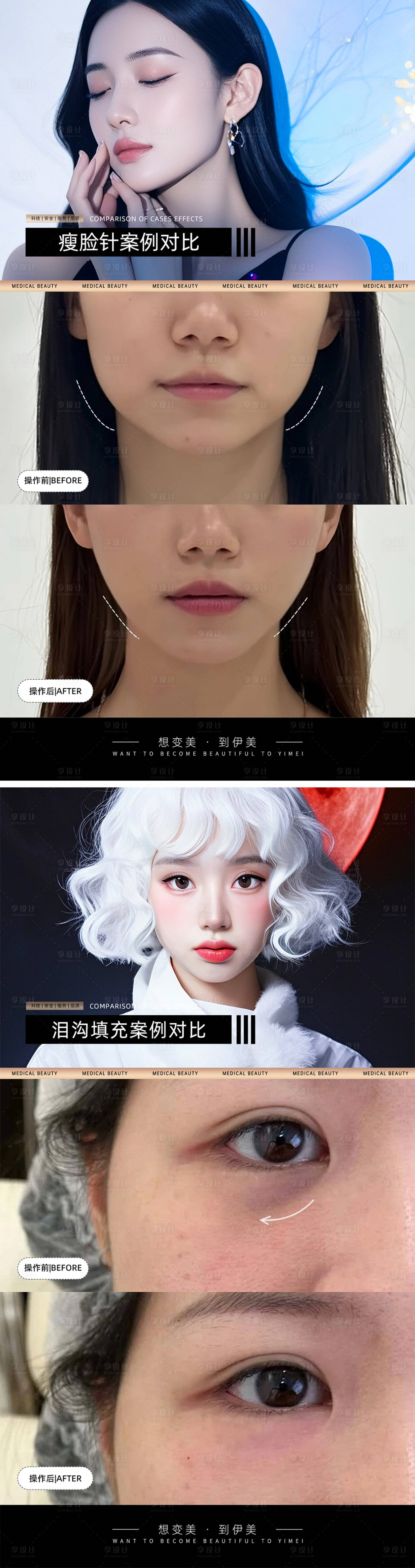 源文件下载【医美案例对比模版】编号：11960026819499449