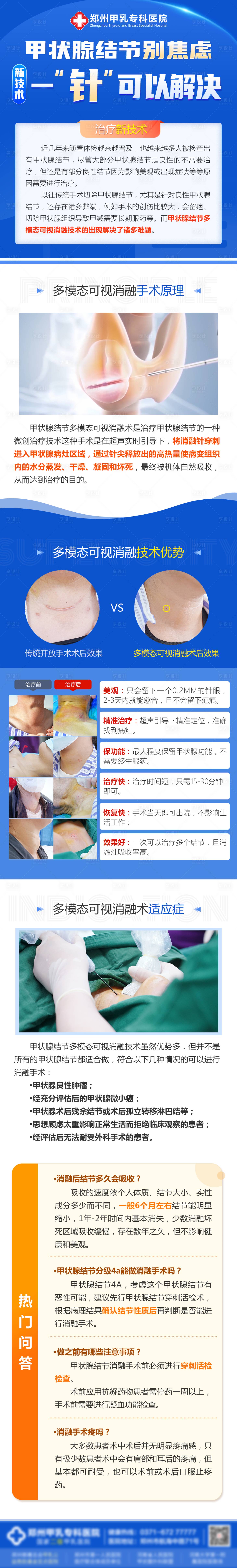 源文件下载【甲状腺结节海报】编号：27630026597151871