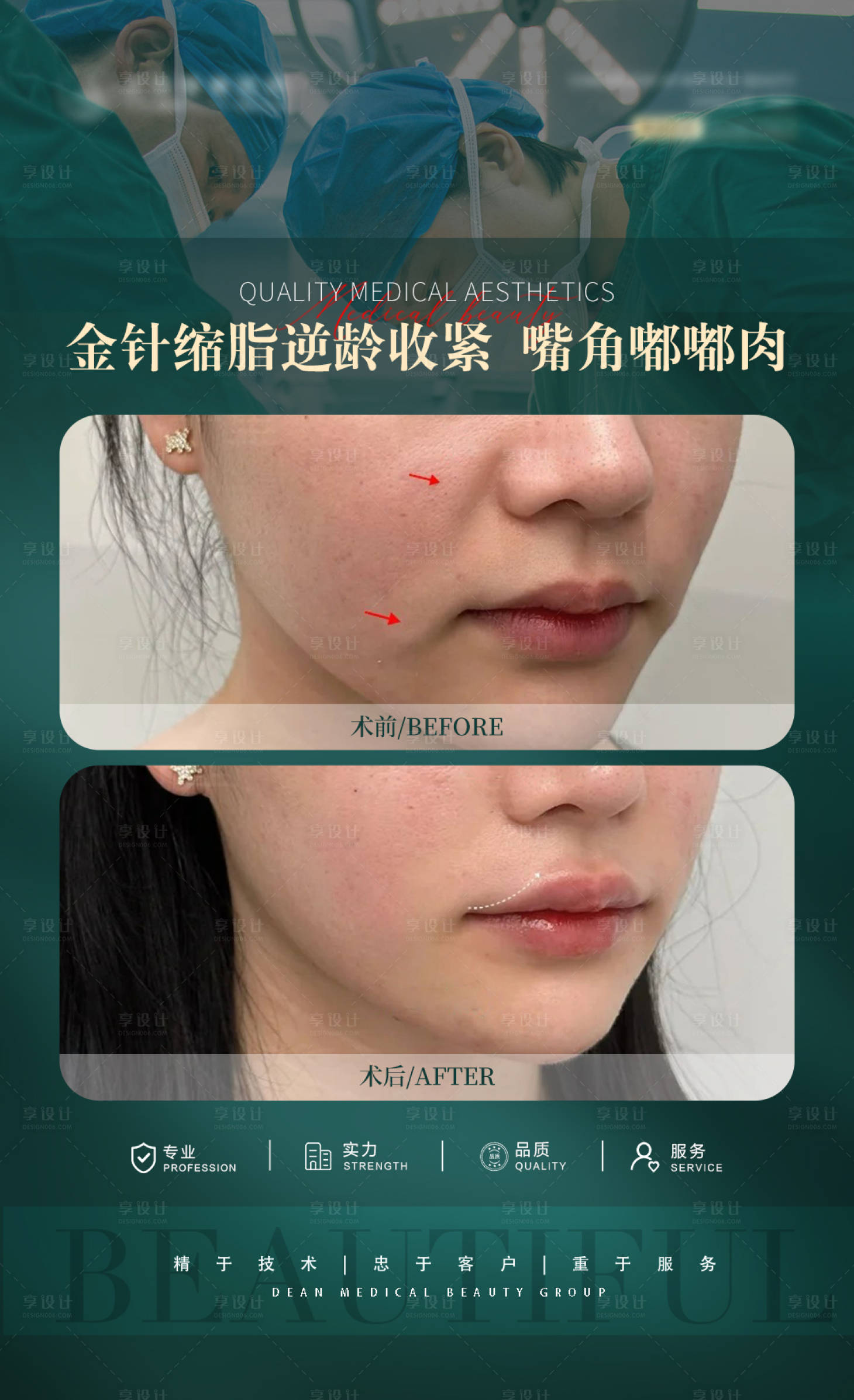 源文件下载【享设计】搜索编号：25230026988477964【医美嘟嘟肉案例对比海报】