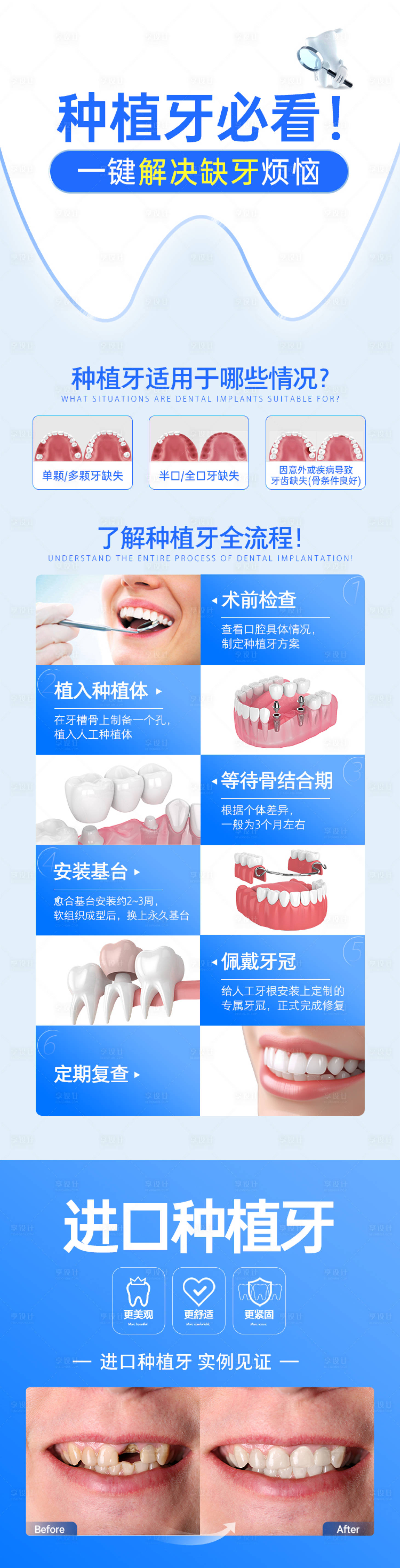 源文件下载【享设计】搜索编号：31710027029083401【牙科口腔科普长图海报】