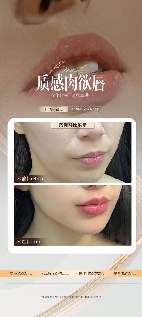 源文件下载【医美嘟嘟唇案例】编号：48930026615699410