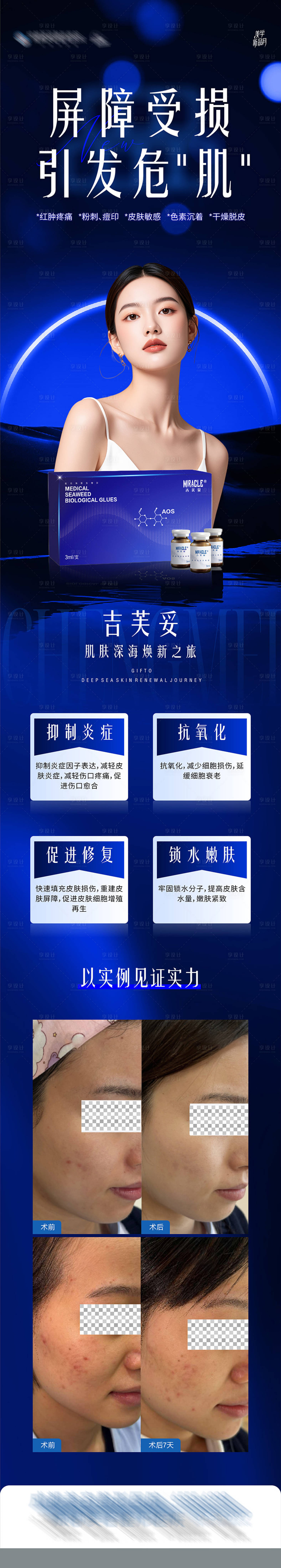 源文件下载【吉芙妥案例长图海报 】编号：52980026717158085