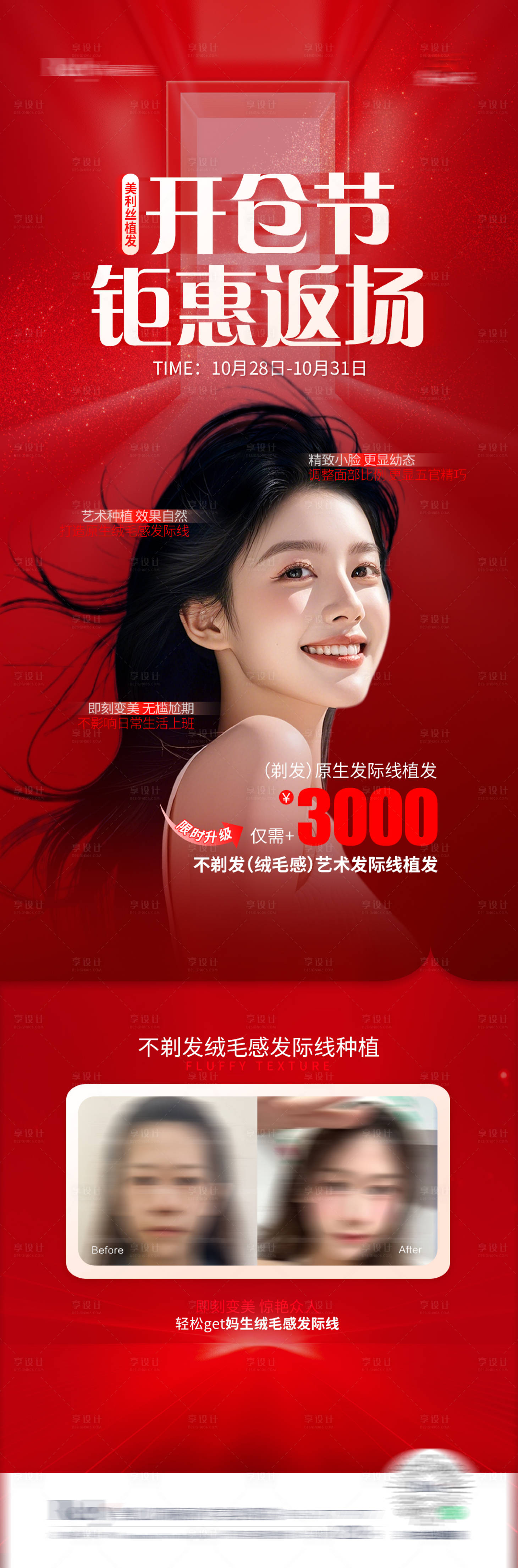 源文件下載【享設(shè)計(jì)】搜索編號(hào)：31300027034199877【醫(yī)美植發(fā)活動(dòng)單圖海報(bào)】