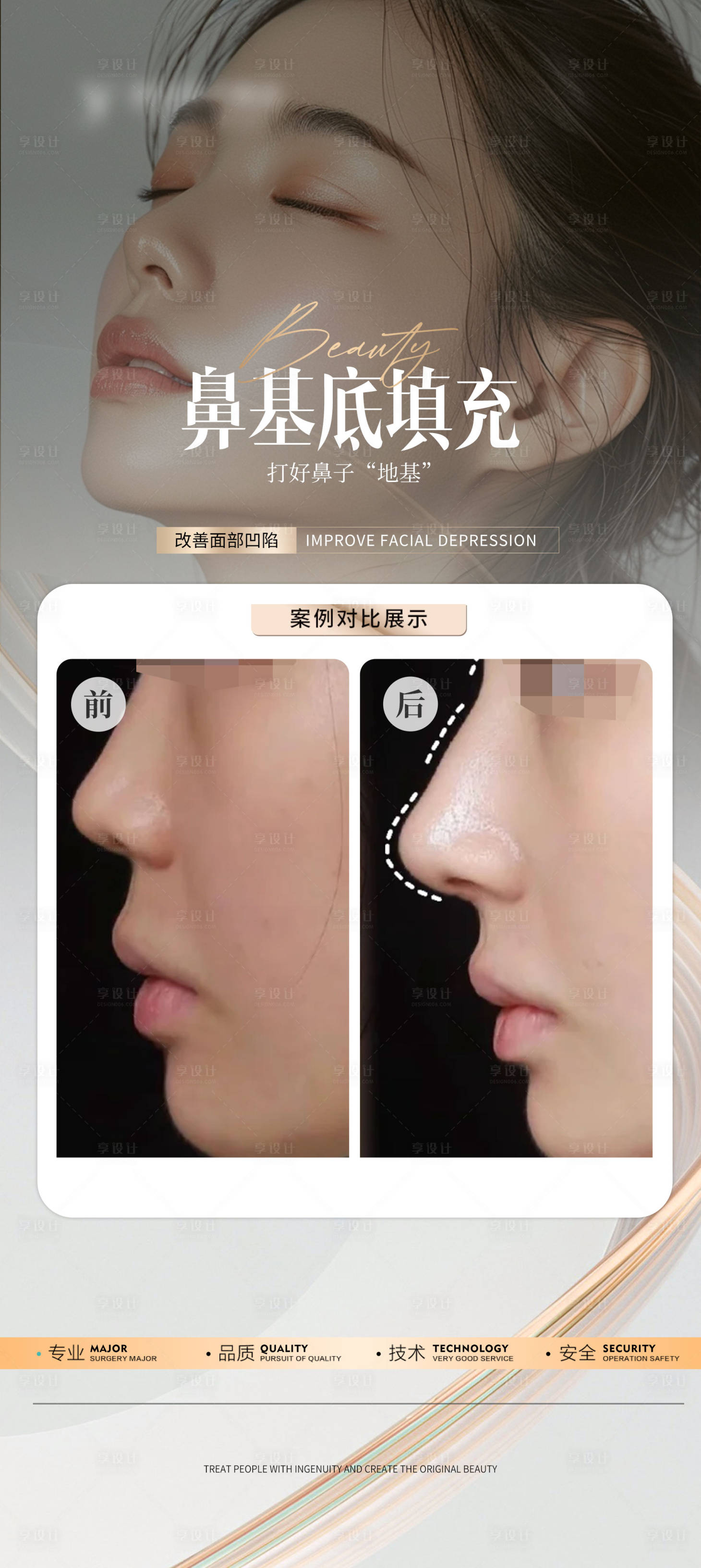 源文件下载【享设计】搜索编号：59230026628322363【医美鼻基底填充案例海报】