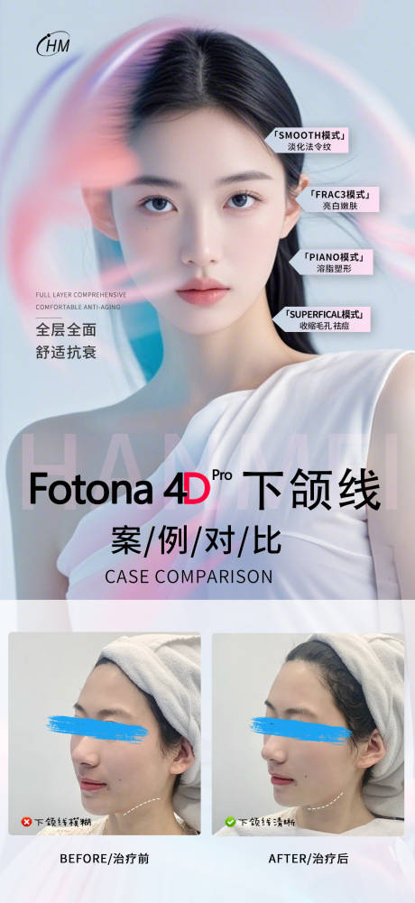 源文件下载【fotona4D案例对比】编号：71490026965423513
