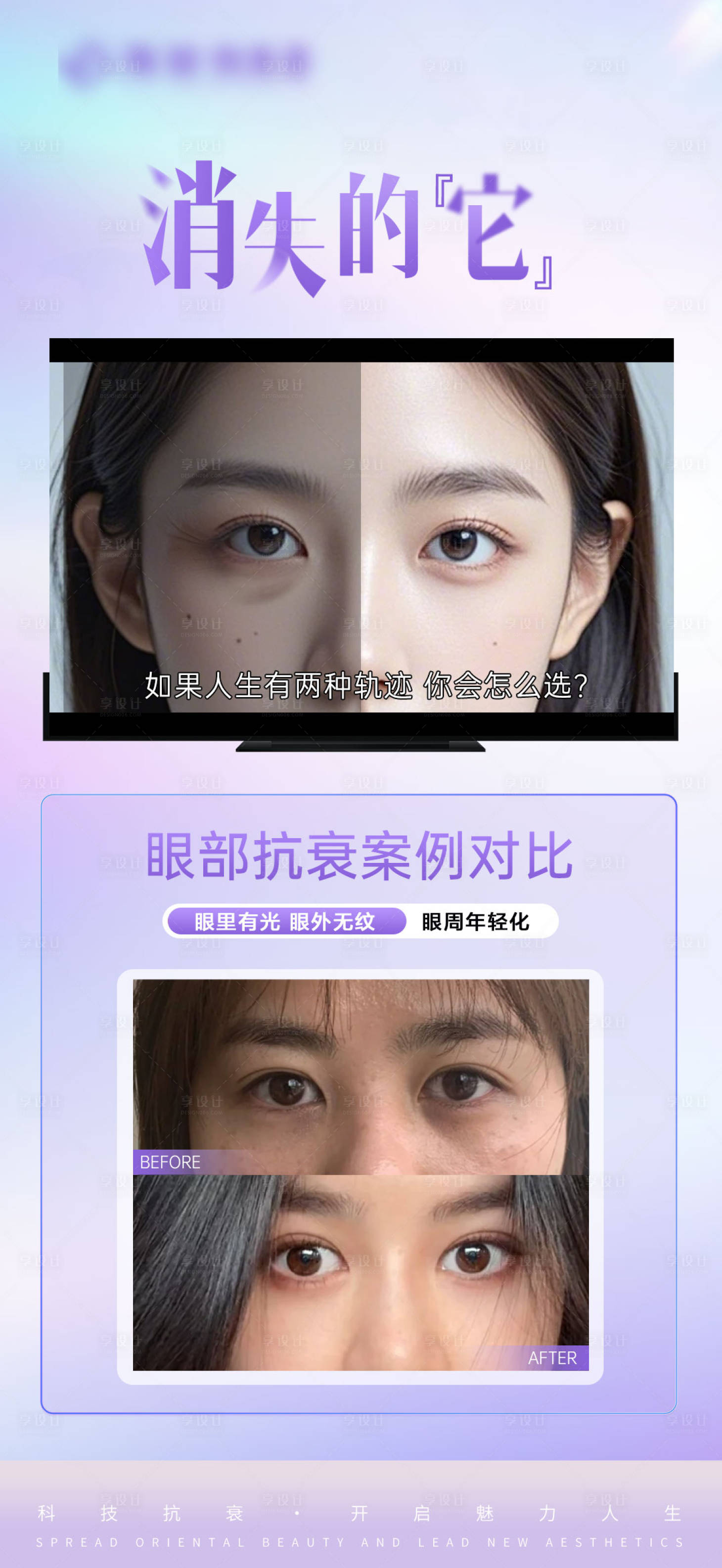 源文件下载【享设计】搜索编号：75620026953895579【医美眼周年轻化抗衰对比海报】
