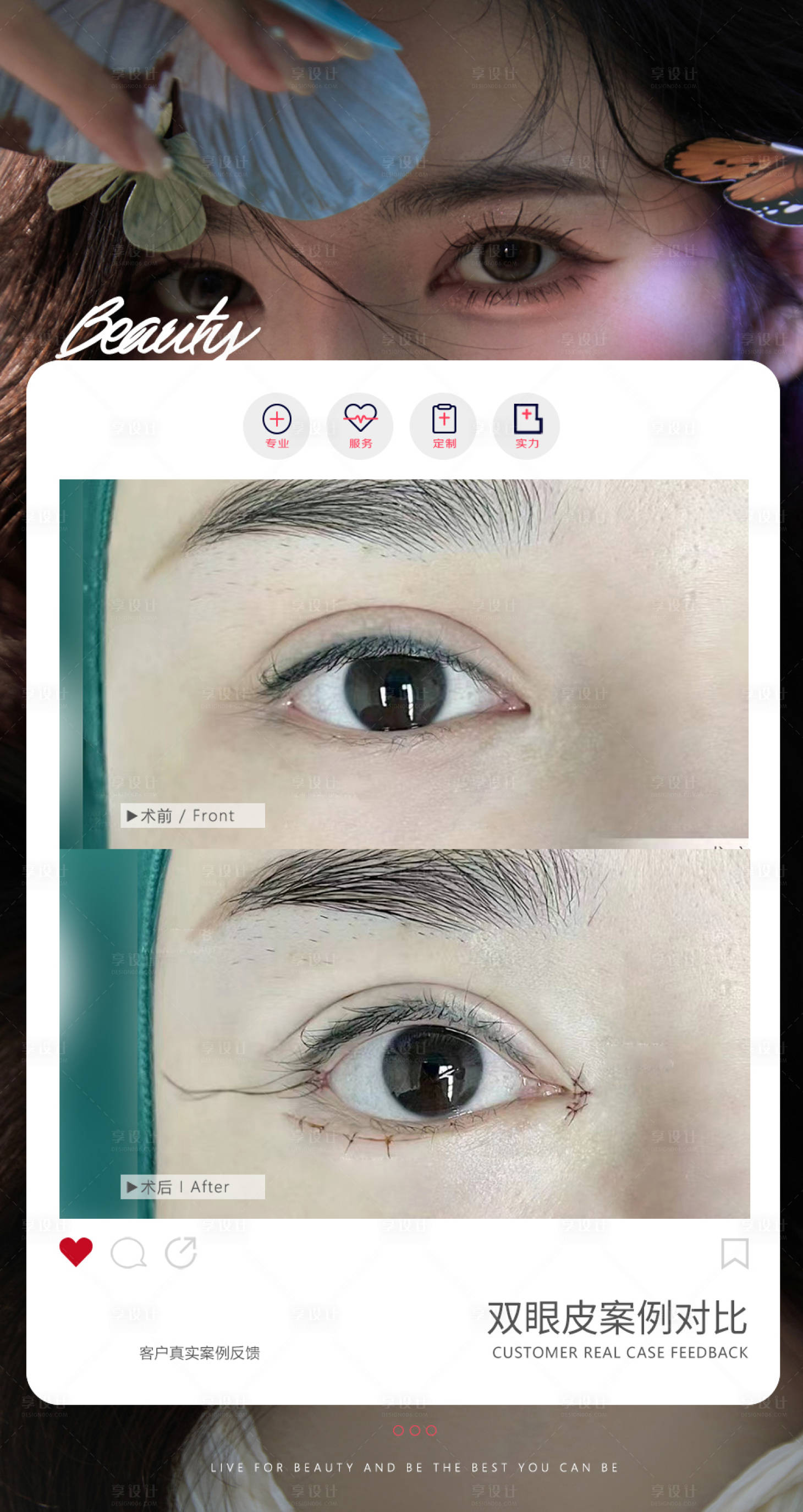 源文件下载【享设计】搜索编号：67560026977673700【医美双眼皮案例】