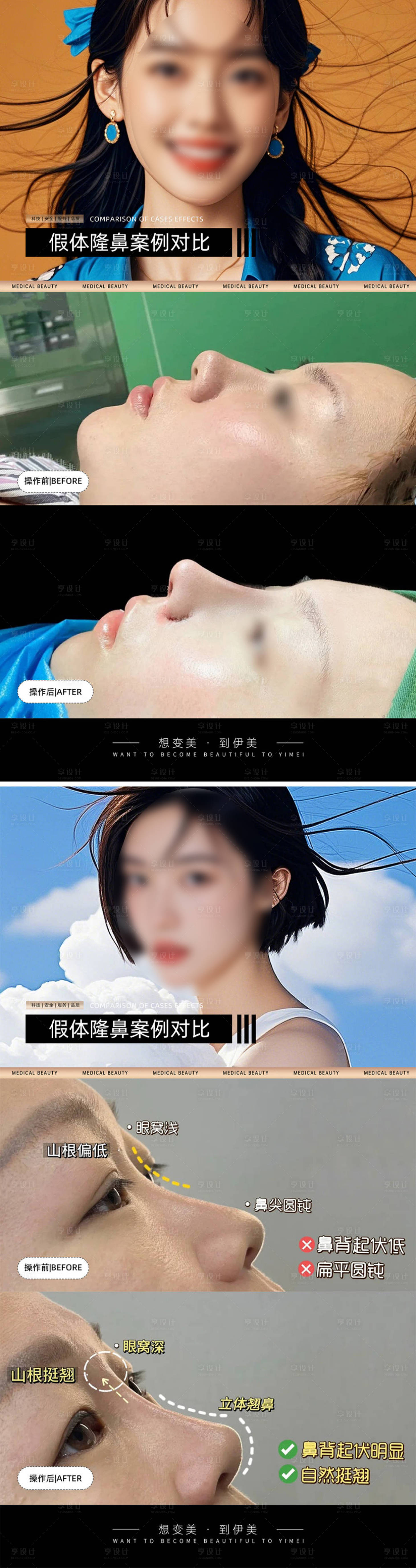 源文件下载【享设计】搜索编号：34960026583779646【医美案例对比海报】