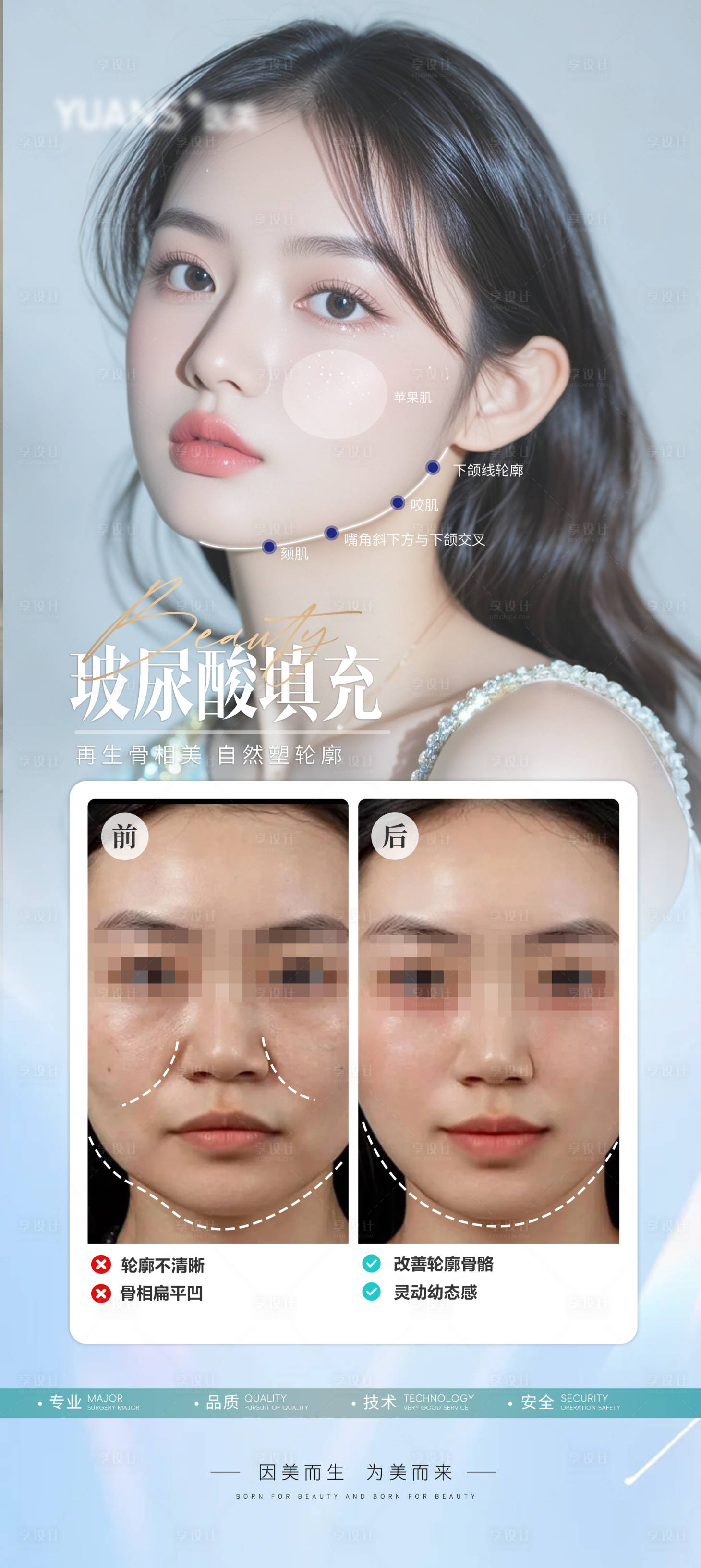 源文件下载【享设计】搜索编号：11090026818756446【医美玻尿酸填充轮廓案例】