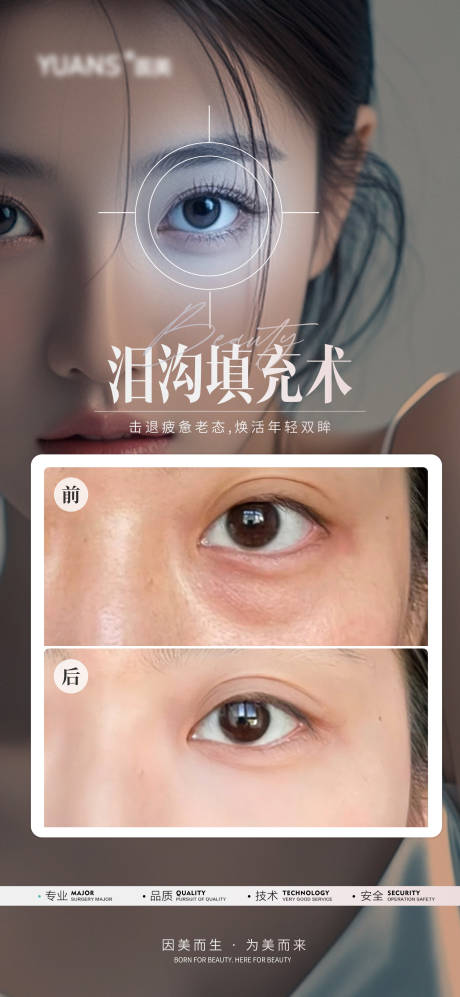 源文件下载【医美泪沟案例】编号：70310026844806153