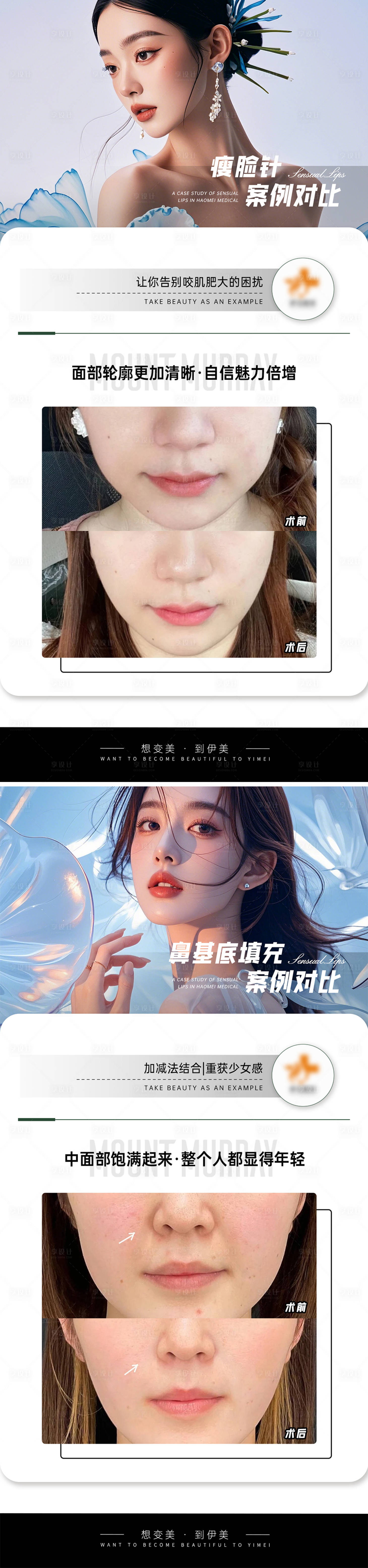 源文件下载【享设计】搜索编号：49990026688599104【医美案例对比模板】