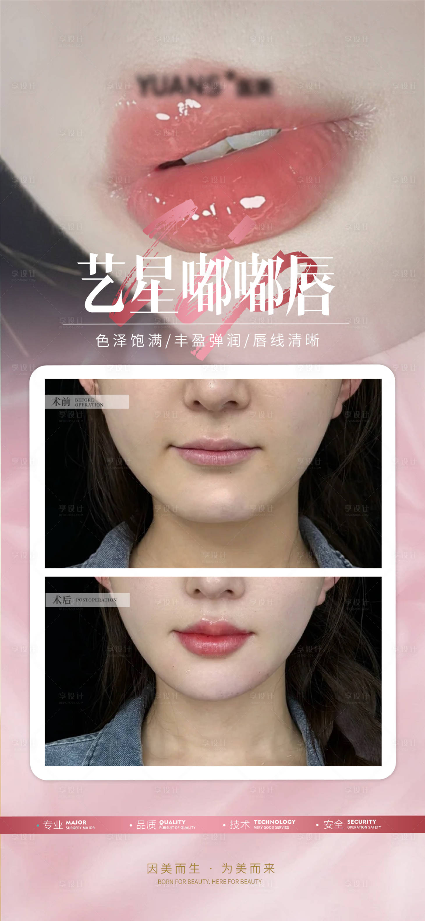 源文件下载【享设计】搜索编号：38850026847696962【医美嘟嘟唇案例海报】