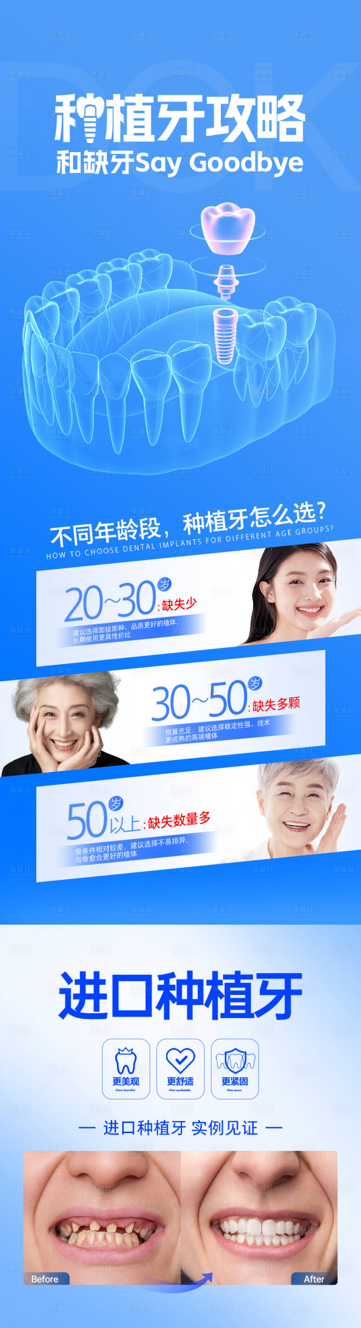 源文件下载【享设计】搜索编号：14150027029097157【牙科科普海报】