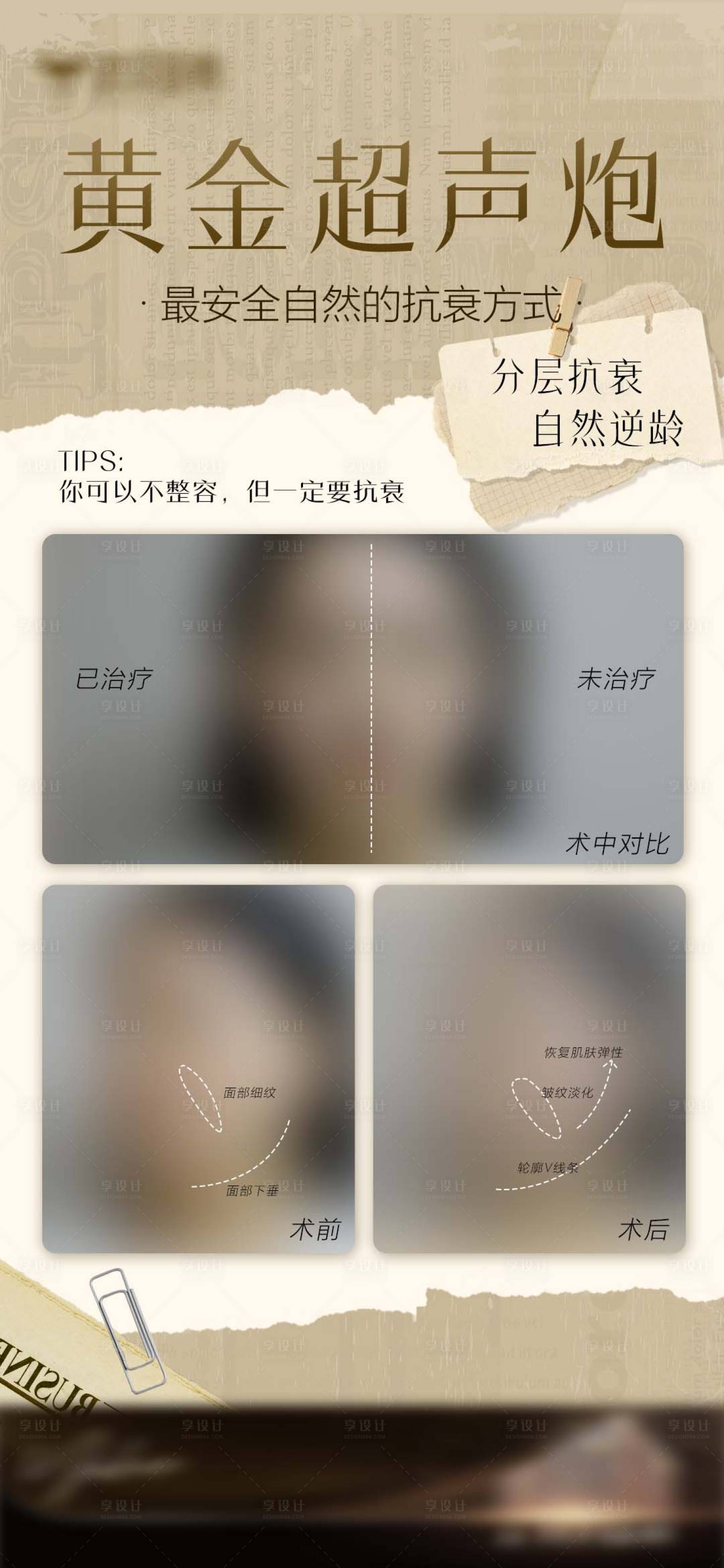 源文件下载【享设计】搜索编号：85720026937007200【黄金超声炮案例对比海报】