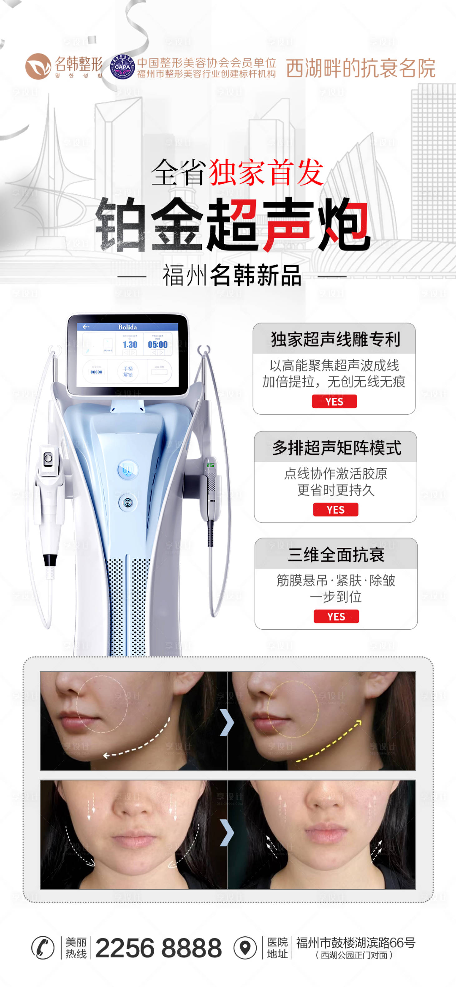 源文件下載【享設(shè)計】搜索編號：84780026567332348【醫(yī)美鉑金超聲炮海報】
