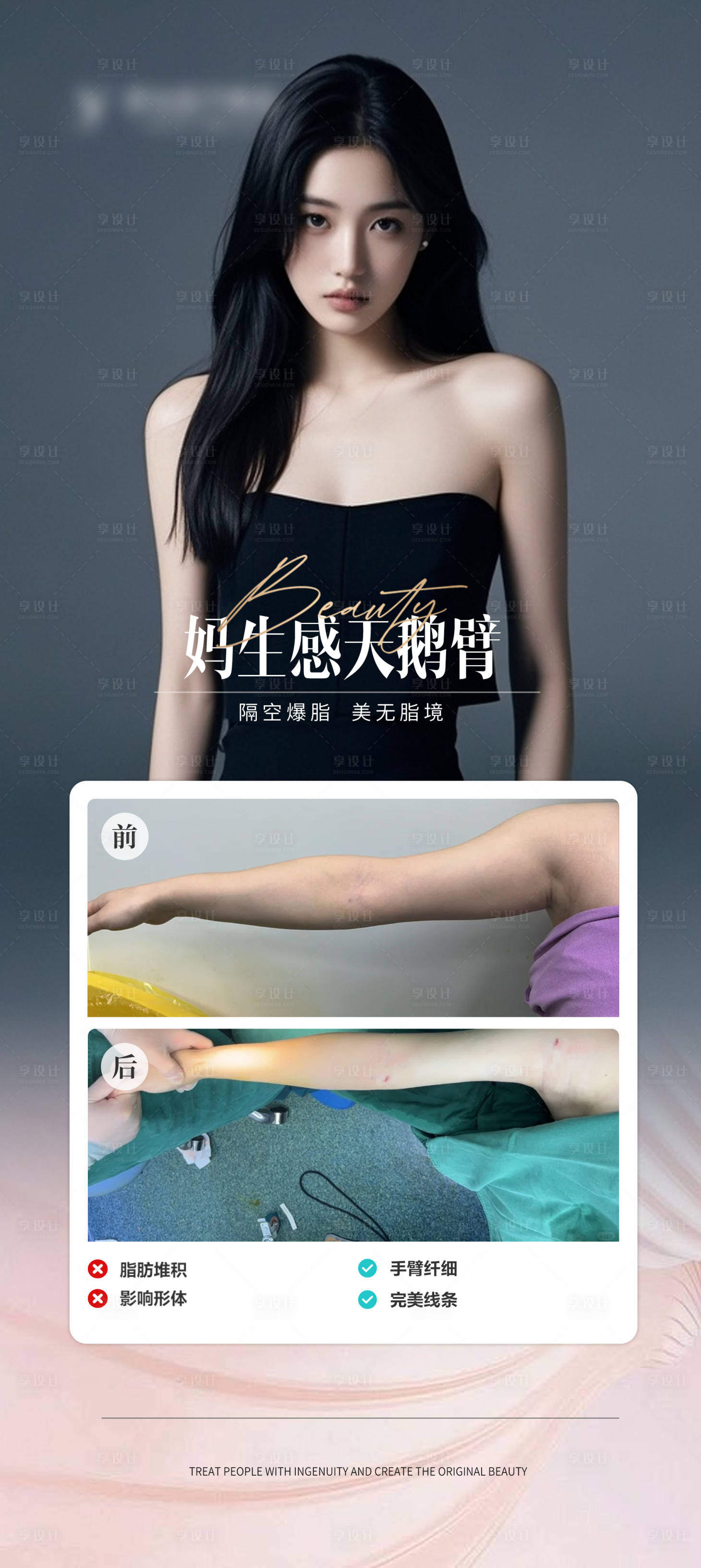 源文件下載【醫美手臂抽脂案例】編號：80280026654854834