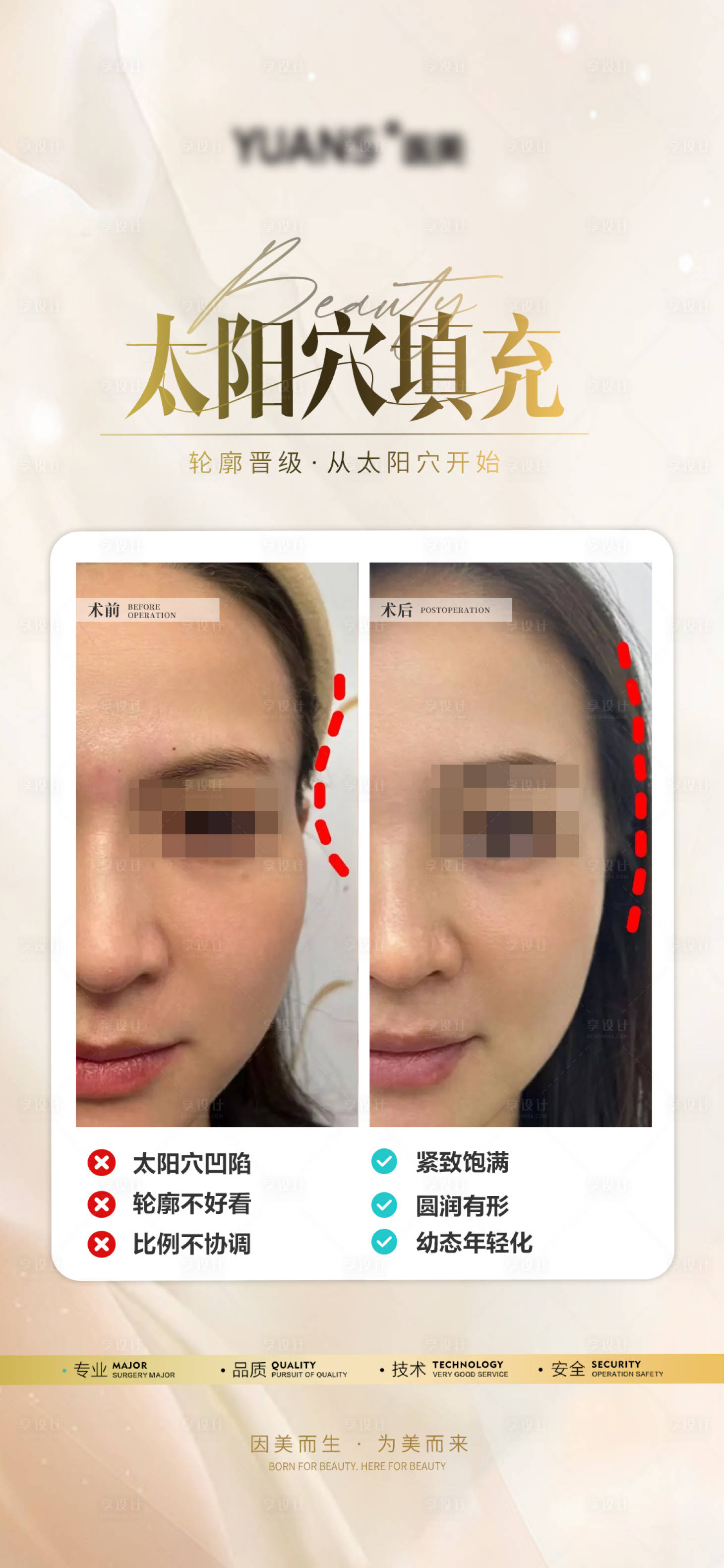 源文件下載【享設計】搜索編號：28440026845931670【醫美太陽穴案例】