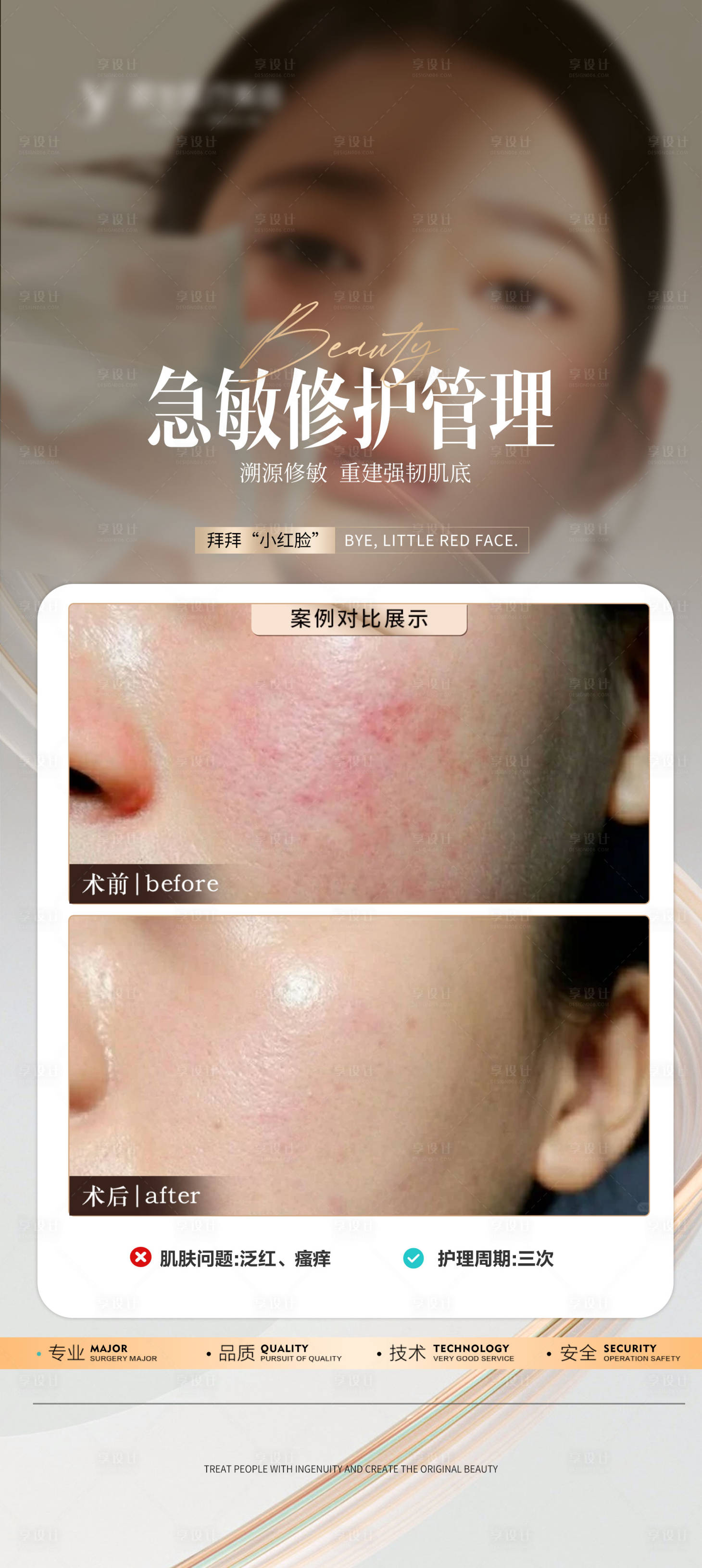 源文件下載【享設(shè)計】搜索編號：27280026643204536【醫(yī)美敏肌修復(fù)案例海報】