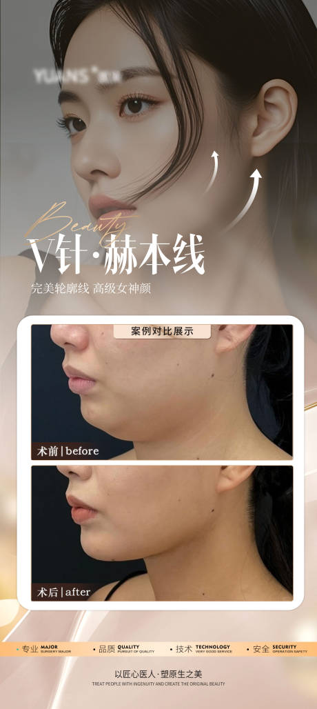 源文件下載【享設計】搜索編號：25730027029807488【醫美下頜緣案例海報】
