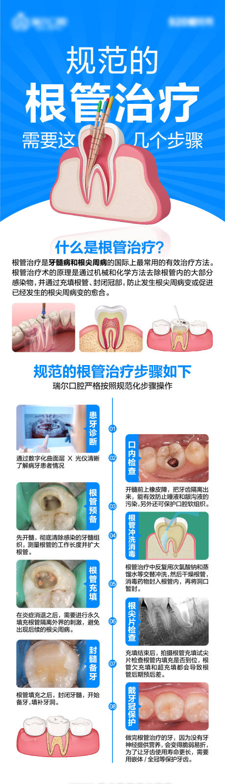 源文件下载【根管治疗流程】编号：26020026663024478