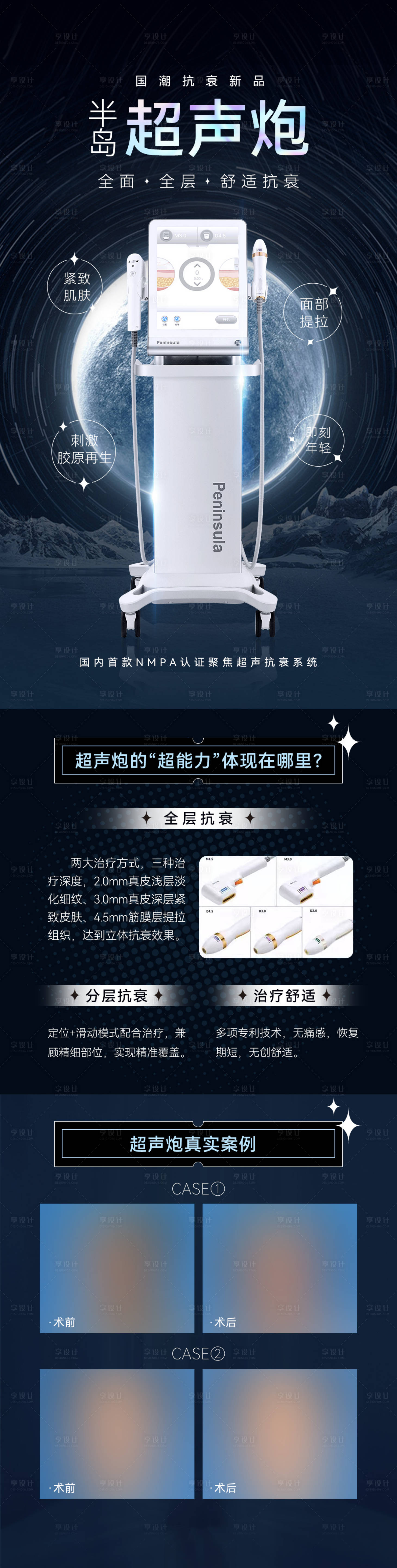 源文件下載【享設(shè)計】搜索編號：92920026631273183【超聲炮專題長圖】