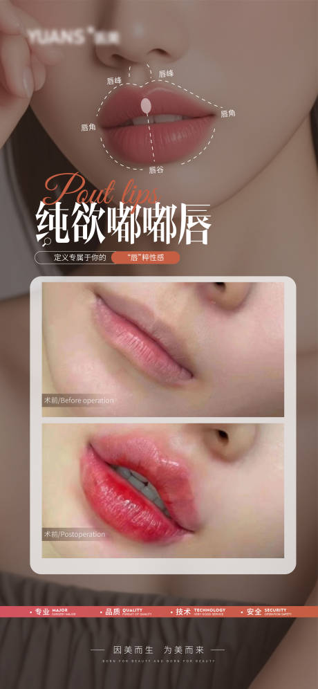 源文件下载【医美嘟嘟唇口周案例海报】编号：70760026762578651