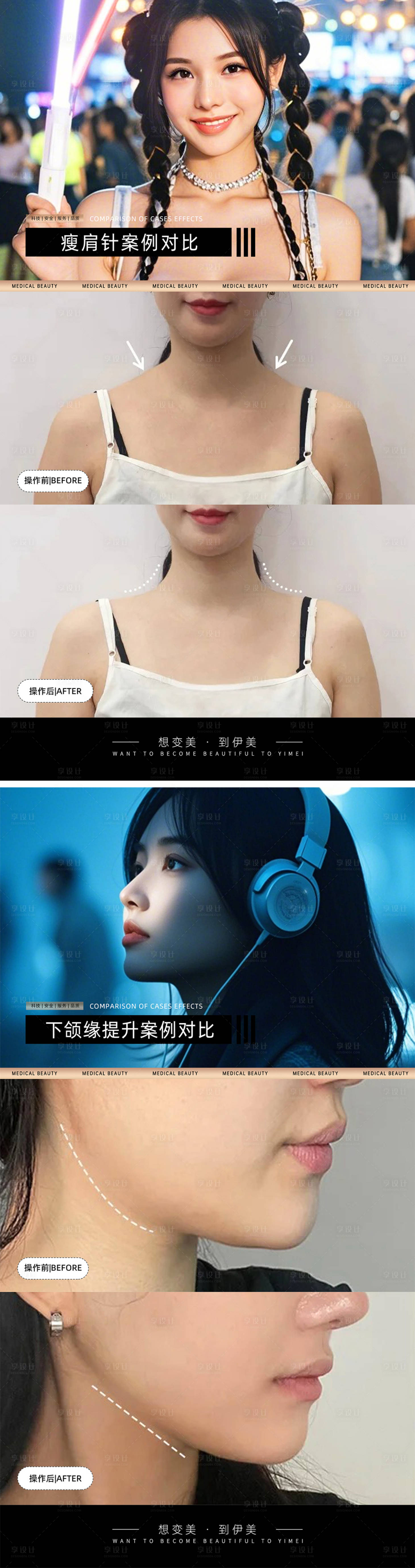源文件下載【享設(shè)計】搜索編號：28610026827656471【醫(yī)美案例對比海報】