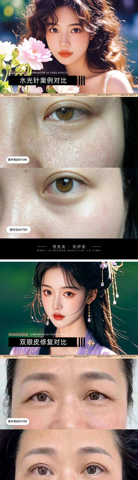 源文件下载【享设计】搜索编号：92050026966113685【医美案例对比模板】