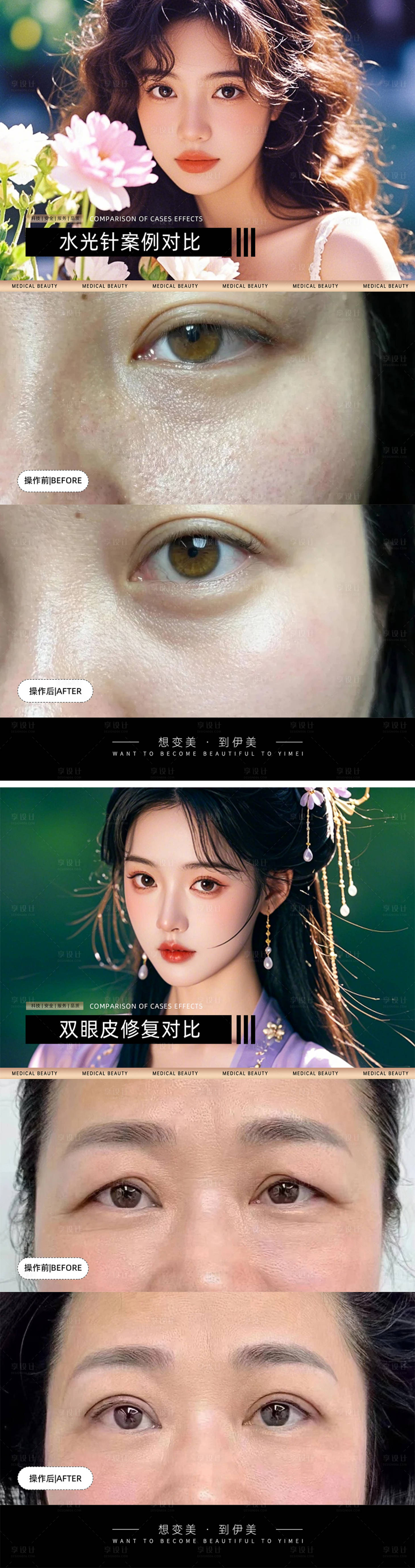 源文件下載【享設(shè)計(jì)】搜索編號(hào)：92050026966113685【醫(yī)美案例對(duì)比模板】