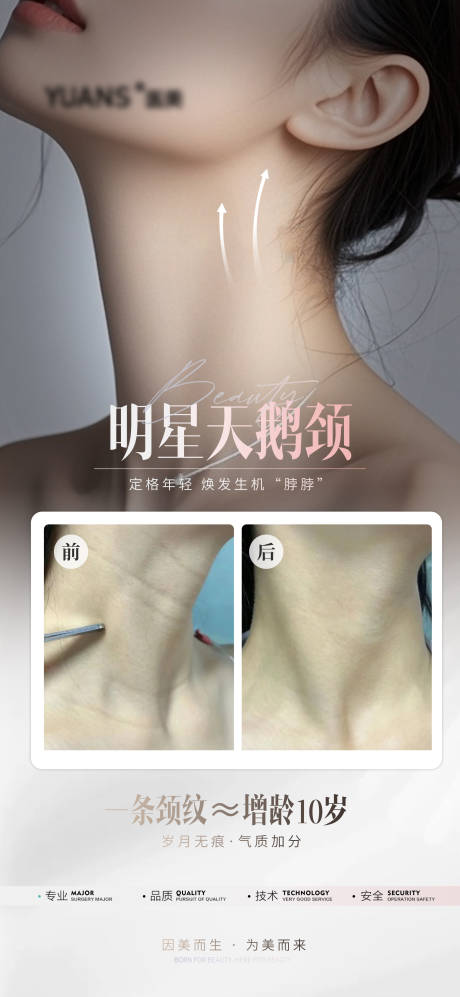 源文件下载【医美颈纹案例】编号：94240026846126235