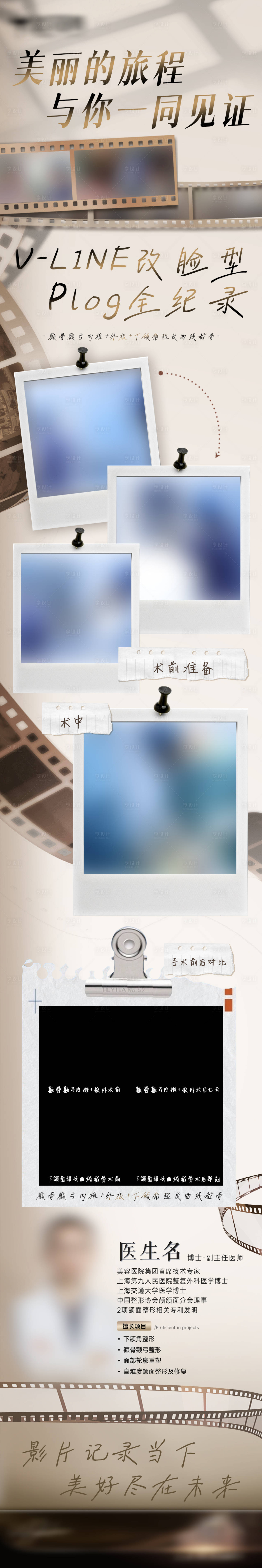 源文件下載【享設計】搜索編號：51790027047833435【醫美專家案例流程長圖】
