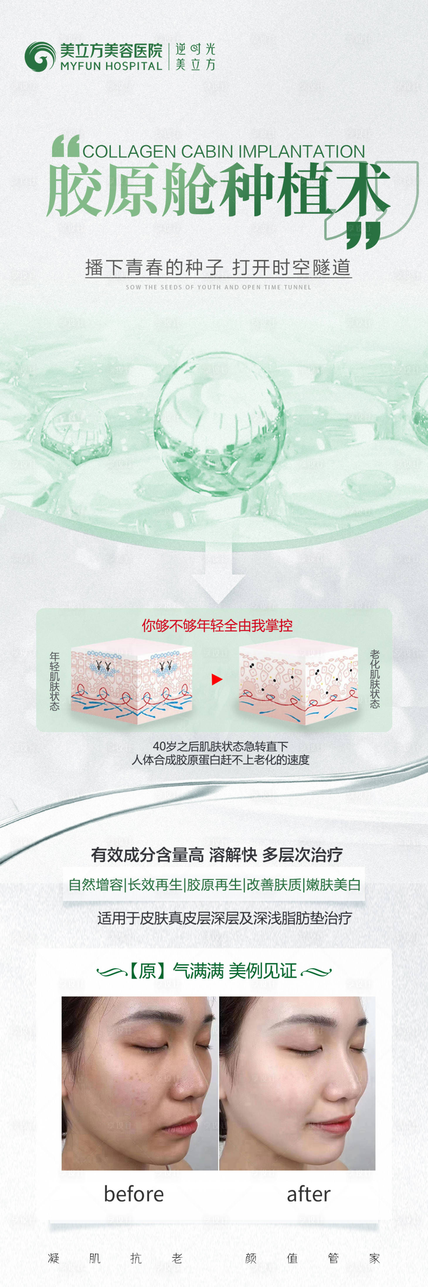 源文件下载【医美整形胶原舱种植术长图】编号：85070026841271071