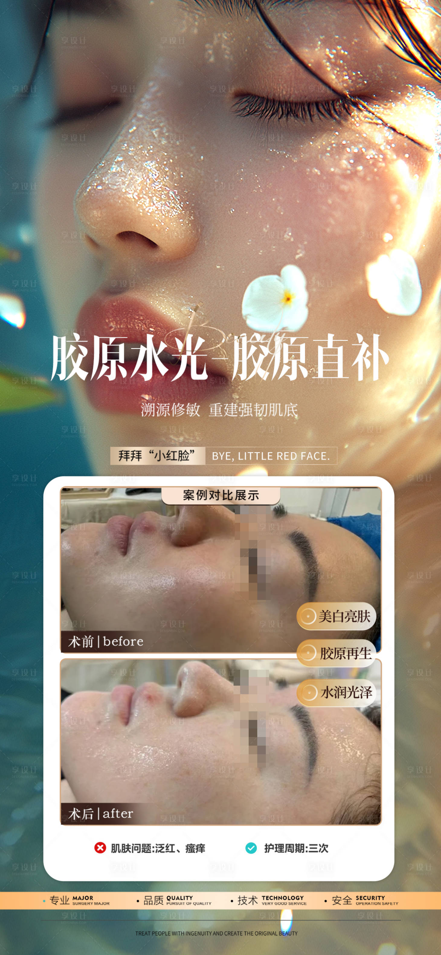 源文件下载【享设计】搜索编号：51050026926032630【医美皮肤案例海报 】