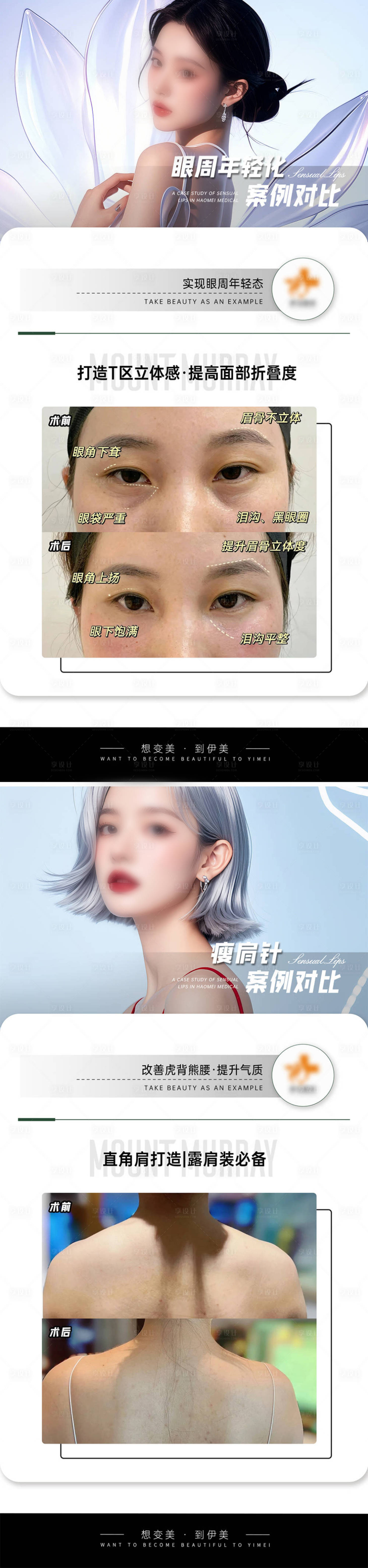源文件下載【享設計】搜索編號：27430026692406773【醫美案例對比模板海報】