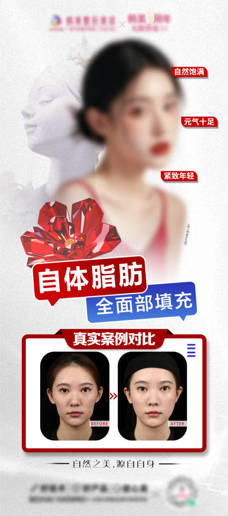 源文件下载【自体脂肪面部填充海报】编号：73420026708948305