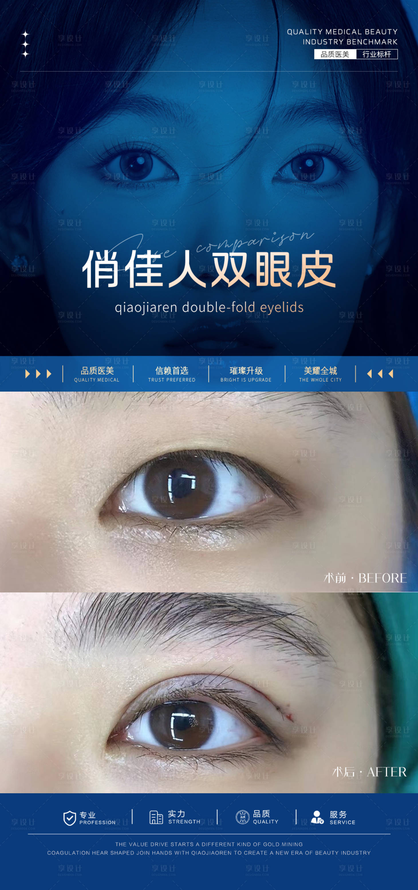 源文件下载【享设计】搜索编号：32320026963851608【双眼皮案例海报】