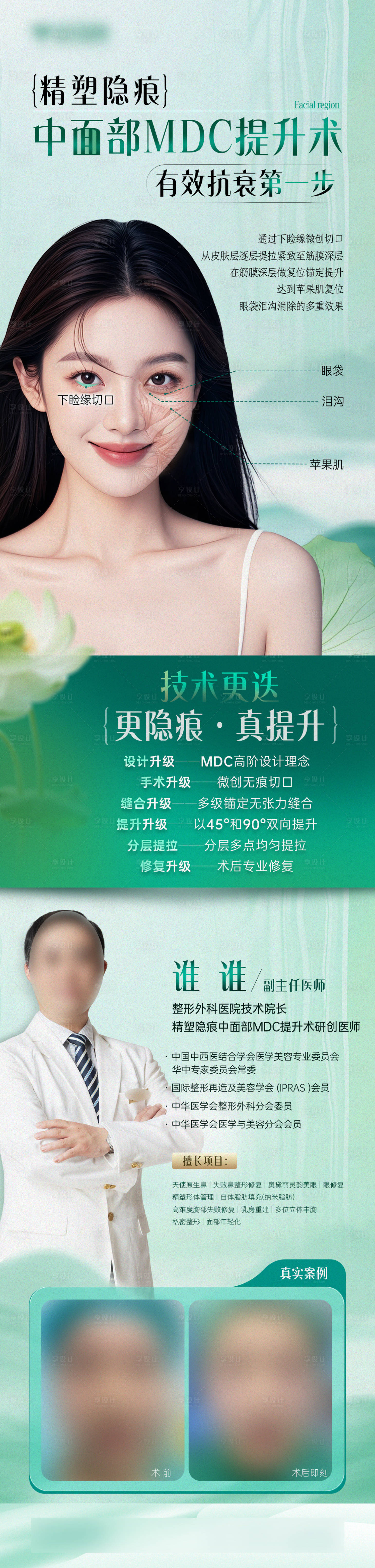 源文件下載【享設計】搜索編號：78550026703192494【醫美中面部提升拉皮專家案例對比長圖】