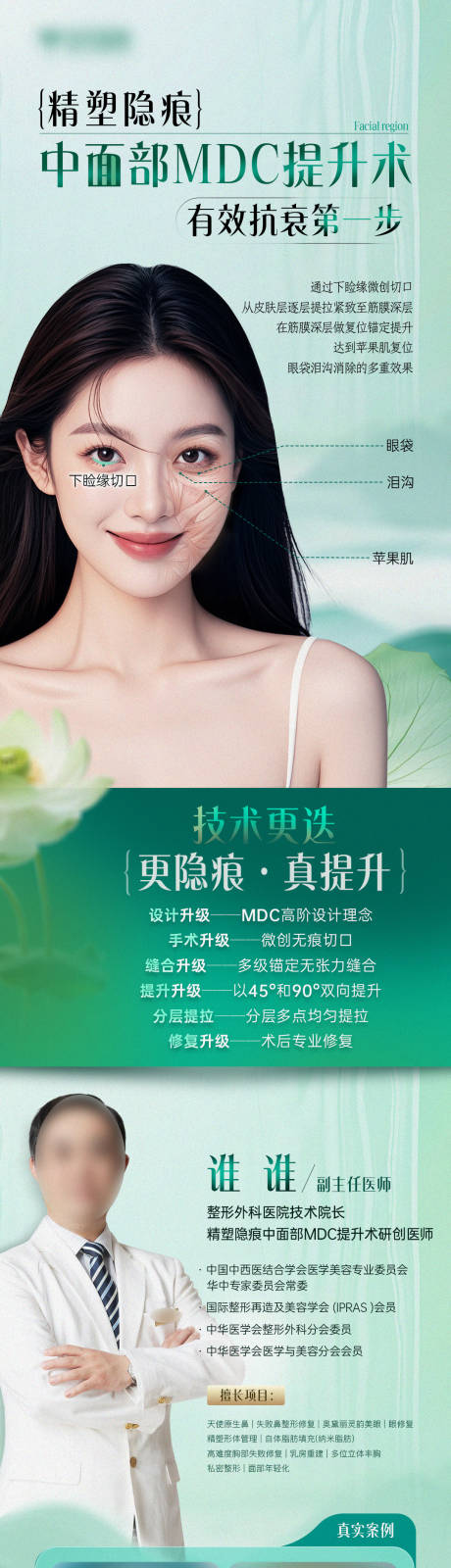 医美中面部提升拉皮专家案例对比长图
