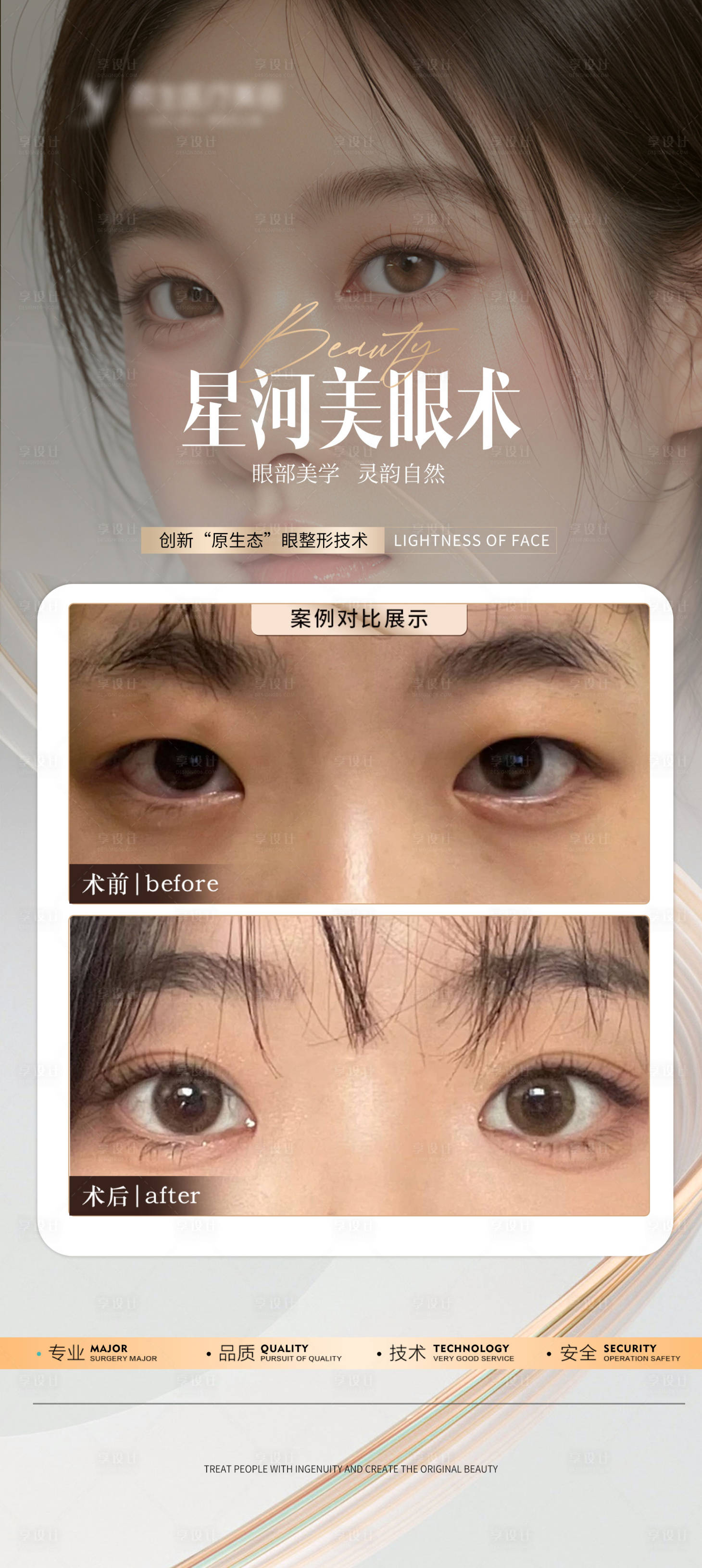 源文件下载【享设计】搜索编号：67250026632375465【医美双眼皮案例海报】